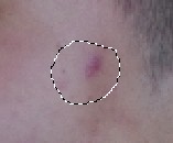 Photoshop快速给男生照片美容去痘和提亮